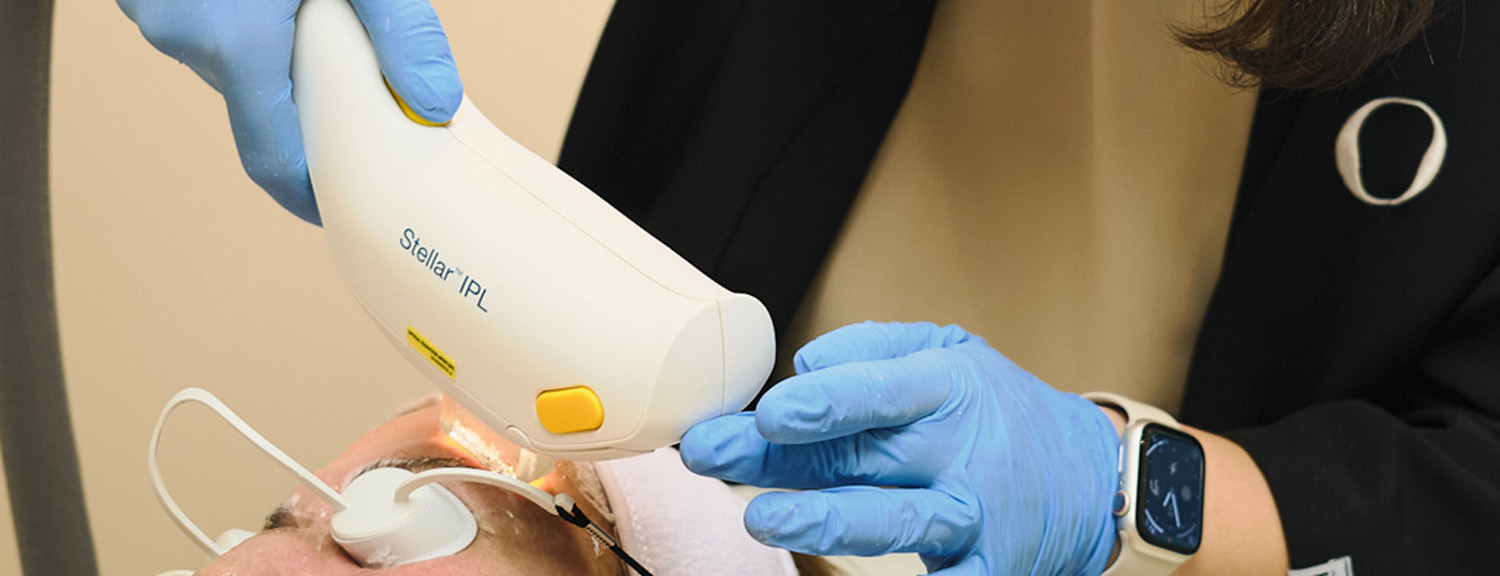 Tratamiento con luz pulsada intensa Lumenis M22 en clínica MOS Medicina Estética Granada