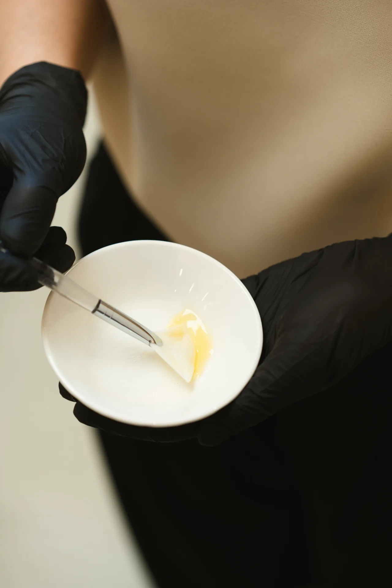 Aplicación de peeling químico en plato blanco durante consulta estética en MOS Granada