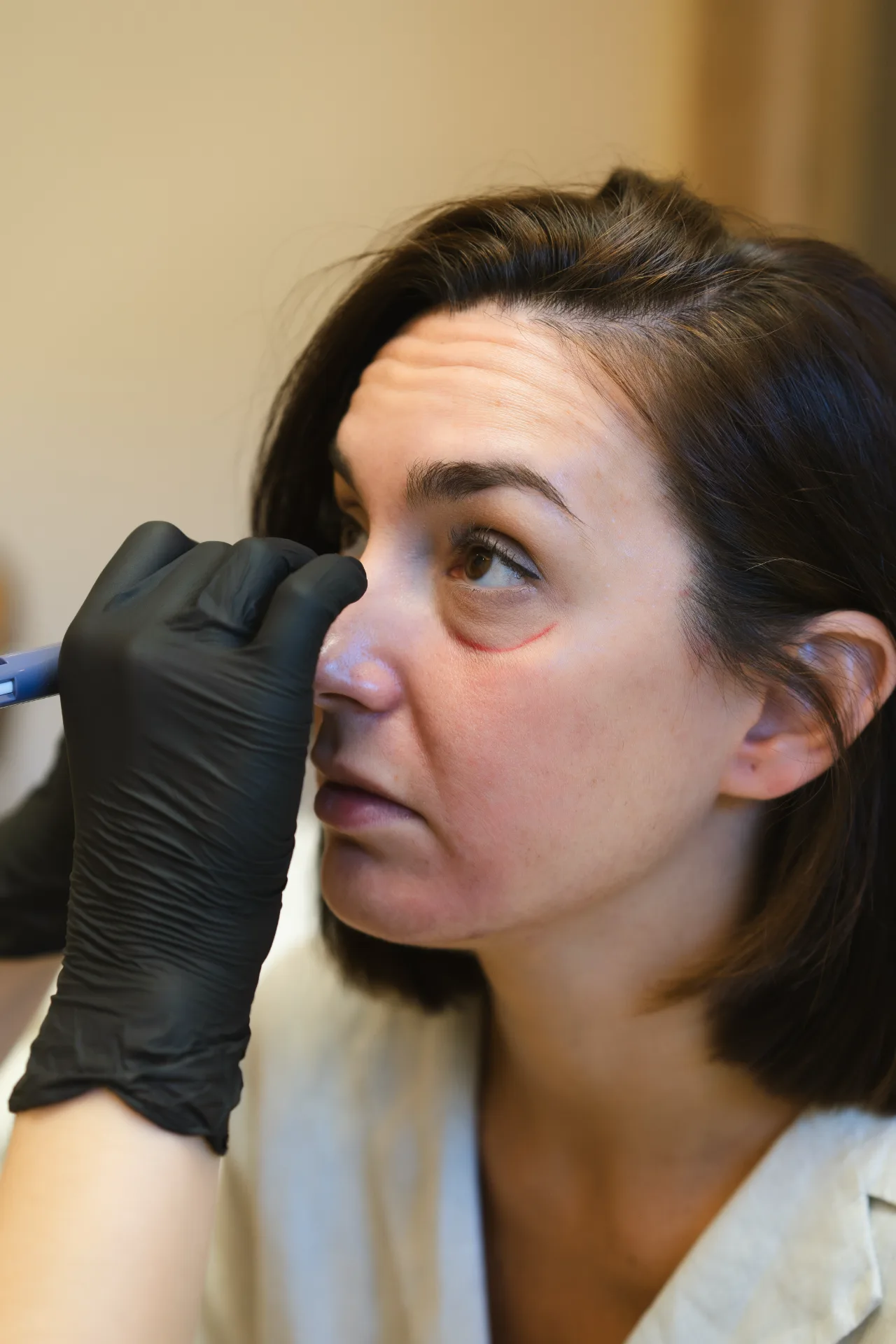 Evaluación de ojeras y contorno ocular en consulta de medicina estética MOS Granada